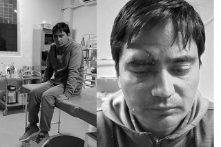नेपाल पत्रकार महासंघ बझाङका अध्यक्षमाथि चक्कु प्रहार